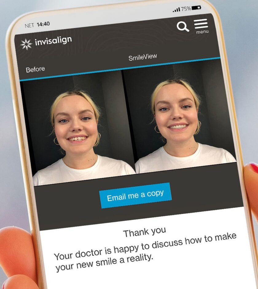 Invisalign SmileView on a phone, showing a before selfie next to the simulated new smile